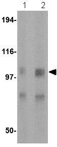 Western blot - Anti-GluK1 antibody (AB118891)