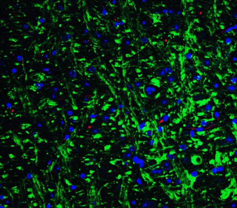 Immunocytochemistry/ Immunofluorescence - Anti-GluK1 antibody (AB67316)