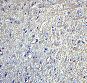 Immunohistochemistry (Formalin/PFA-fixed paraffin-embedded sections) - Anti-GluK1 antibody (AB67316)