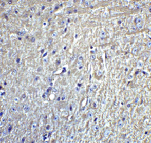 Immunohistochemistry (Formalin/PFA-fixed paraffin-embedded sections) - Anti-GluK1 antibody (AB67316)
