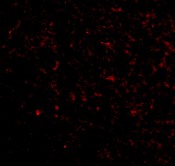 Immunocytochemistry/ Immunofluorescence - Anti-GluK5 antibody (AB67408), expandable thumbnail
