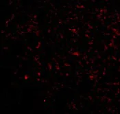 Immunocytochemistry/ Immunofluorescence - Anti-GluK5 antibody (AB67408)