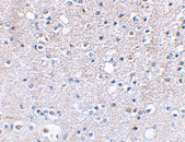 Immunohistochemistry (Formalin/PFA-fixed paraffin-embedded sections) - Anti-GluK5 antibody (AB67408), expandable thumbnail
