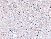 Immunohistochemistry (Formalin/PFA-fixed paraffin-embedded sections) - Anti-GluK5 antibody (AB67408)