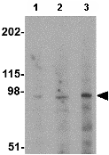 Western blot - Anti-GluK5 antibody (AB67408), expandable thumbnail