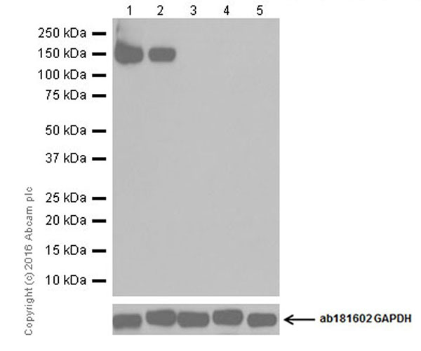 Western blot - Anti-GluN2C antibody [EPR18949] (AB182278)