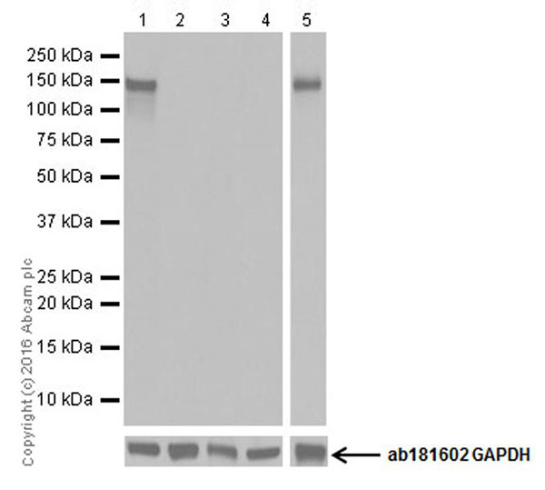 Western blot - Anti-GluN2C antibody [EPR19046] (AB192831), expandable thumbnail
