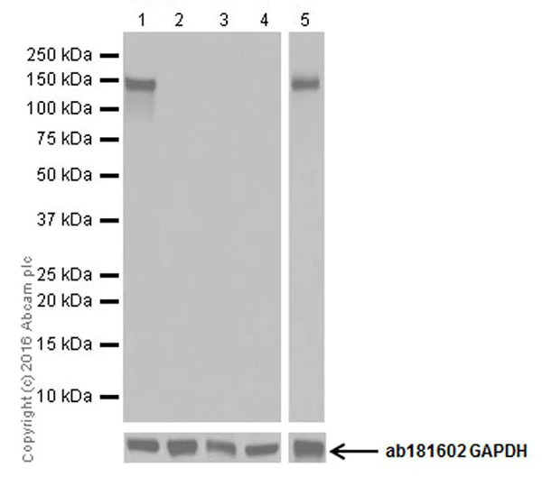Western blot - Anti-GluN2C antibody [EPR19046] (AB192831)
