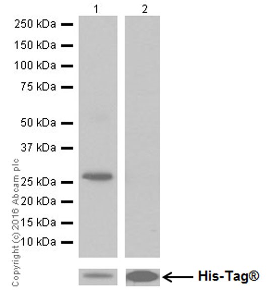 Western blot - Anti-GluN2C antibody [EPR19094] (AB182277)