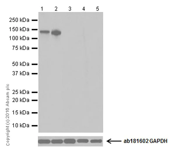 Western blot - Anti-GluN2C antibody [EPR19094] (AB182277)