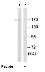 Western blot - Anti-GluN2D antibody (AB92743)