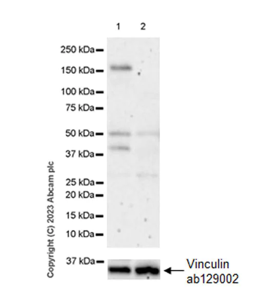 Western blot - Anti-GluN2D antibody [EPR28378-56] (AB314664)
