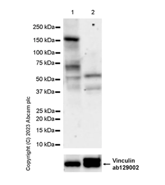 Western blot - Anti-GluN2D antibody [EPR28378-56] (AB314664)
