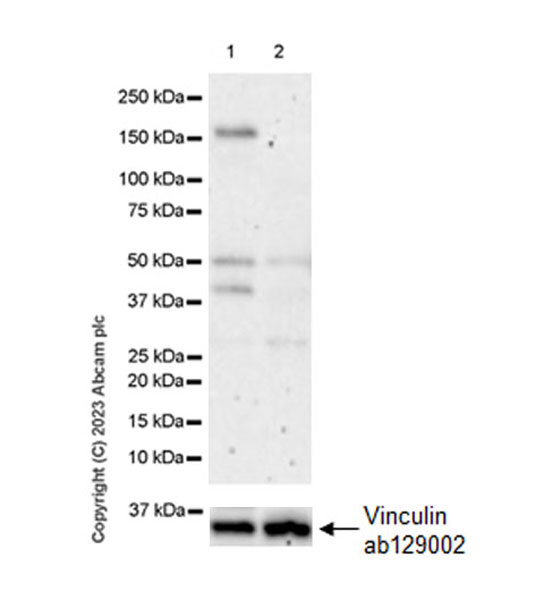Western blot - Anti-GluN2D antibody [EPR28378-56] - BSA and Azide free (AB314665), expandable thumbnail