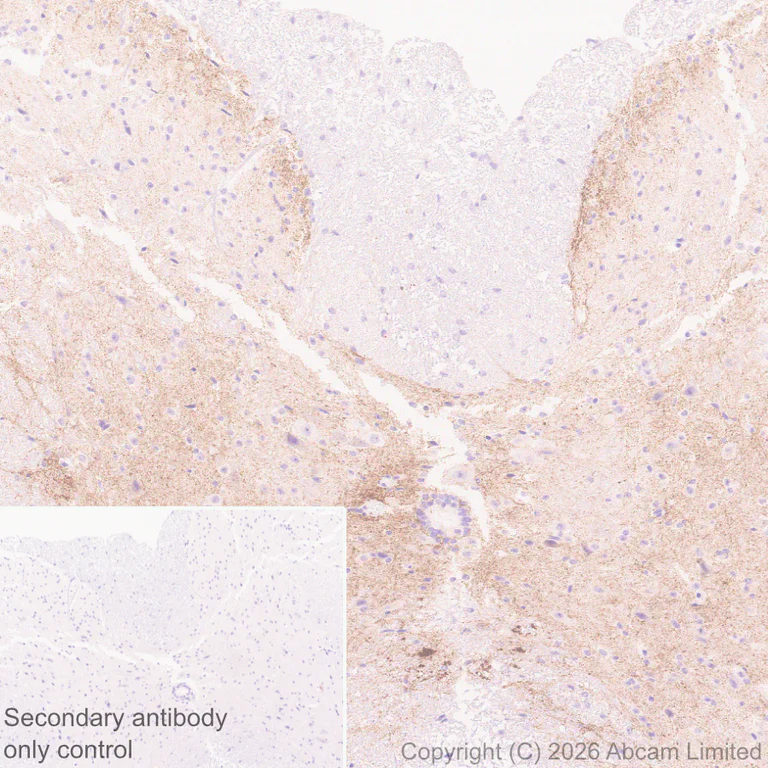 Immunohistochemistry (Formalin/PFA-fixed paraffin-embedded sections) - Anti-GluN2D antibody [EPR30355-38] (AB326329)