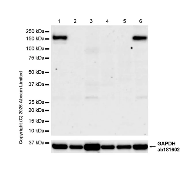 Western blot - Anti-GluN2D antibody [EPR30355-38] (AB326329)