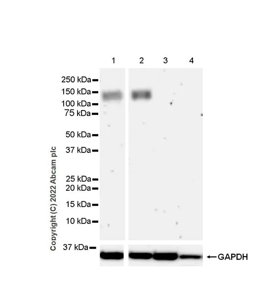 Western blot - Anti-GluN3A+GluN3B antibody [EPR25287-45] (AB302534)