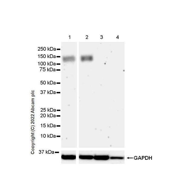 Western blot - Anti-GluN3A+GluN3B antibody [EPR25287-45] (BSA and Azide free) (AB302535), expandable thumbnail