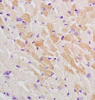 Immunohistochemistry (Formalin/PFA-fixed paraffin-embedded sections) - Anti-GLUT12 antibody (AB202908)