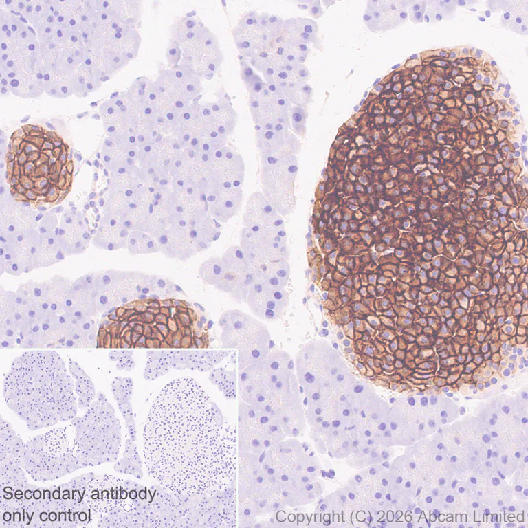 Immunohistochemistry (Formalin/PFA-fixed paraffin-embedded sections) - Anti-GLUT2 antibody [EPR31052-27] (AB326936)