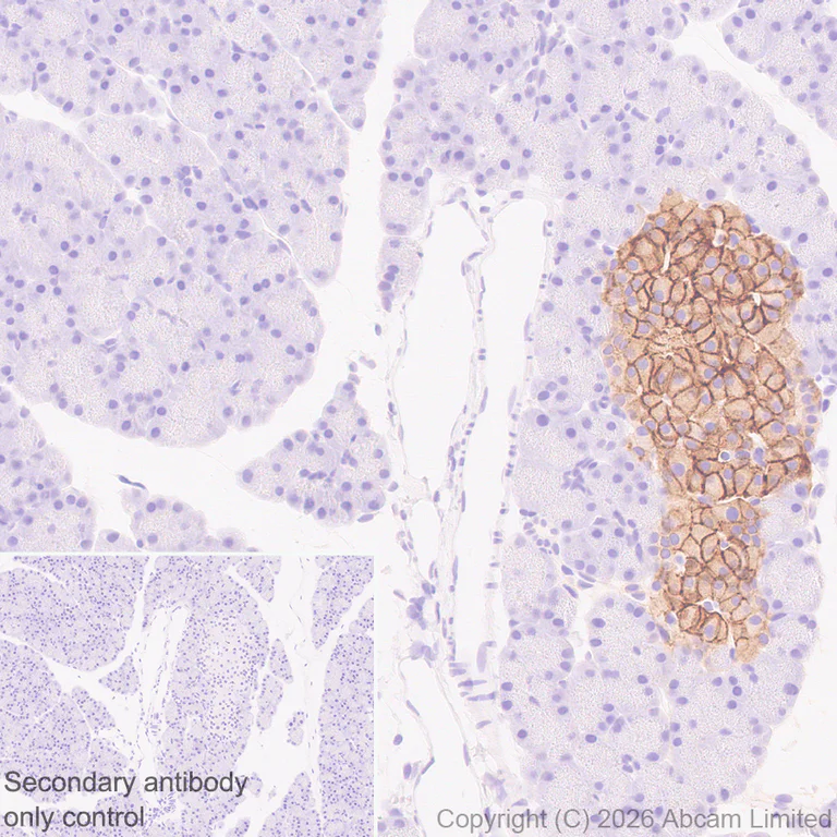 http www.abcam.com glutathione-s-transferase-mu-antibody-epr19362-ab108524.html Anti-Glutathione Synthetase antibody [EPR6562] (ab124811) Suitable for WB Glutathione-S-Transferase (GST)-Agarose antibody A8580 Anti-GST