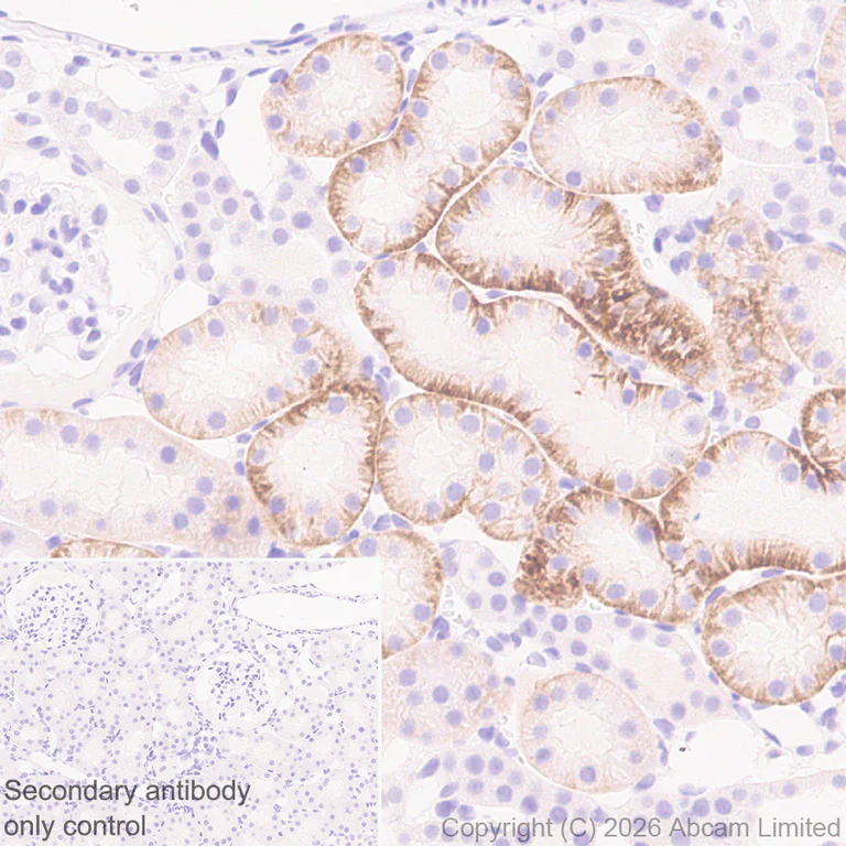 Immunohistochemistry (Formalin/PFA-fixed paraffin-embedded sections) - Anti-GLUT2 antibody [EPR31052-27] (AB326936)