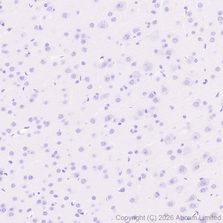 Immunohistochemistry (Formalin/PFA-fixed paraffin-embedded sections) - Anti-GLUT2 antibody [EPR31052-27] (AB326936)