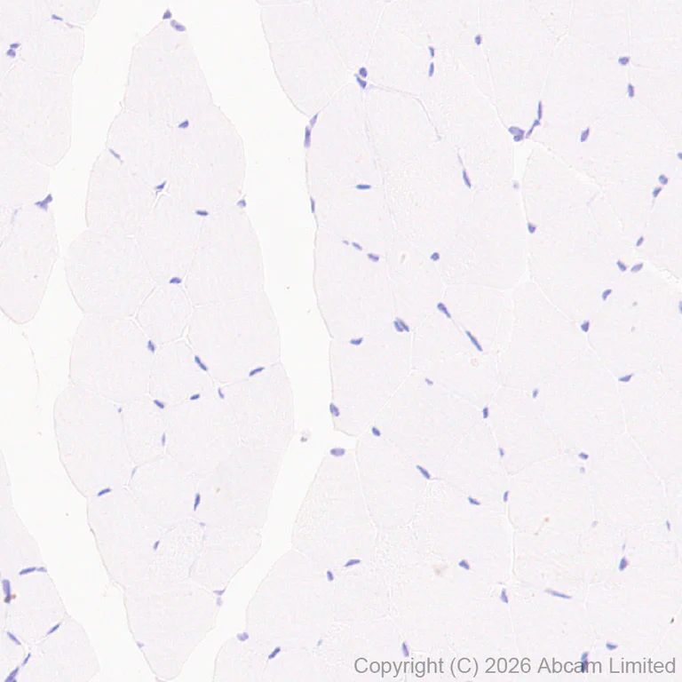 Immunohistochemistry (Formalin/PFA-fixed paraffin-embedded sections) - Anti-GLUT2 antibody [EPR31052-27] (AB326936)