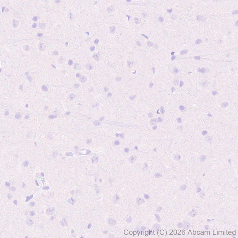 Immunohistochemistry (Formalin/PFA-fixed paraffin-embedded sections) - Anti-GLUT2 antibody [EPR31052-27] (AB326936)