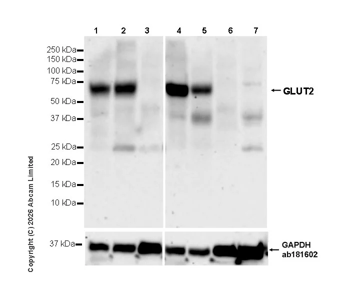 Western blot - Anti-GLUT2 antibody [EPR31052-27] (AB326936)