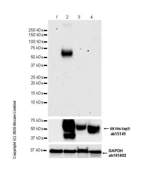 Western blot - Anti-GLUT2 antibody [EPR31052-27] (AB326936)