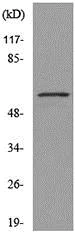 Western blot - Anti-GLUT5 antibody - N-terminal (AB190555)