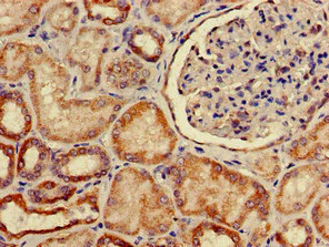 Immunohistochemistry (Formalin/PFA-fixed paraffin-embedded sections) - Anti-GLUT9 antibody (AB223470)