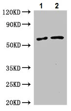 Western blot - Anti-GLUT9 antibody (AB223470)