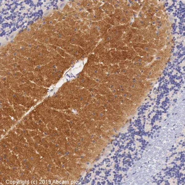 Anti-Glutamate Receptor 1 (AMPA subtype) antibody (ab31232