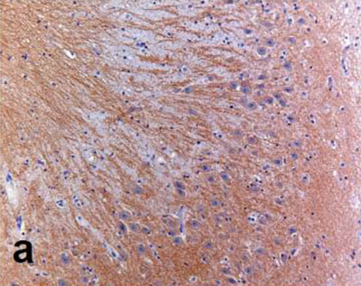 Immunohistochemistry (Formalin/PFA-fixed paraffin-embedded sections) - Anti-Glutamate Receptor 1 (AMPA subtype) antibody [E308] (AB32436), expandable thumbnail