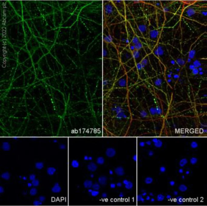 Immunocytochemistry/ Immunofluorescence - Anti-Glutamate Receptor 1 (AMPA subtype) antibody [N355/1] - N-terminal (AB174785)