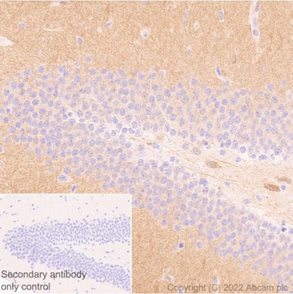 Immunohistochemistry (Formalin/PFA-fixed paraffin-embedded sections) - Anti-Glutamate Receptor 1 (AMPA subtype) antibody [N355/1] - N-terminal (AB174785), expandable thumbnail