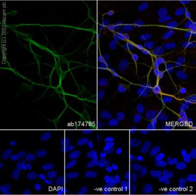 Immunocytochemistry/ Immunofluorescence - Anti-Glutamate Receptor 1 (AMPA subtype) antibody [N355/1] - N-terminal - BSA and Azide free (AB303678)