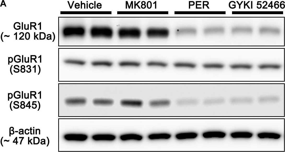 Western blot - Anti-Glutamate Receptor 1 (AMPA subtype) (phospho S831) antibody [EPR1887] (AB109464), expandable thumbnail