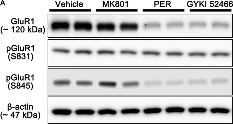 Western blot - Anti-Glutamate Receptor 1 (AMPA subtype) (phospho S831) antibody [EPR1887] (AB109464)