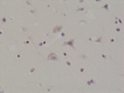 Immunohistochemistry (Formalin/PFA-fixed paraffin-embedded sections) - Anti-Glutamate Receptor 1 (AMPA subtype) (phospho S845) antibody [RM296] (AB222761)