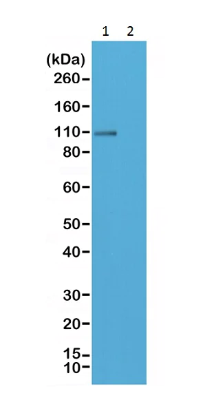 Western blot - Anti-Glutamate Receptor 1 (AMPA subtype) (phospho S845) antibody [RM296] (AB222761)