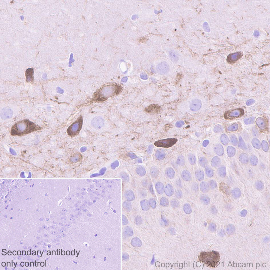 Immunohistochemistry (Formalin/PFA-fixed paraffin-embedded sections) - Anti-Glutamate receptor 4 antibody [EPR24283-69] (AB280199), expandable thumbnail