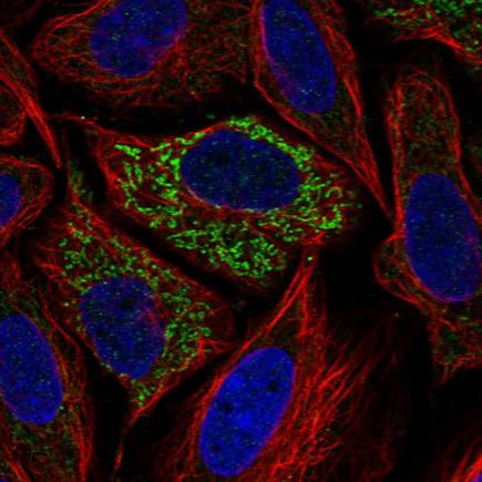 Immunocytochemistry/ Immunofluorescence - Anti-Glutaminase antibody (AB260047), expandable thumbnail