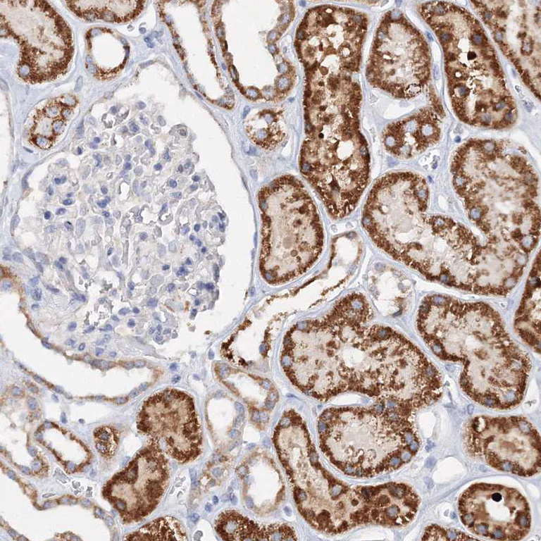 Immunohistochemistry (Formalin/PFA-fixed paraffin-embedded sections) - Anti-Glutaminase antibody (AB260047)