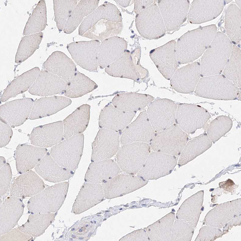 Immunohistochemistry (Formalin/PFA-fixed paraffin-embedded sections) - Anti-Glutaminase antibody (AB260047), expandable thumbnail