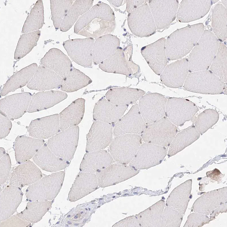 Immunohistochemistry (Formalin/PFA-fixed paraffin-embedded sections) - Anti-Glutaminase antibody (AB260047)