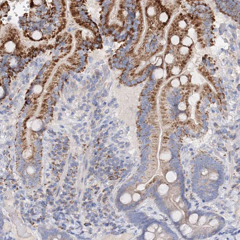 Immunohistochemistry (Formalin/PFA-fixed paraffin-embedded sections) - Anti-Glutaminase antibody (AB260047)