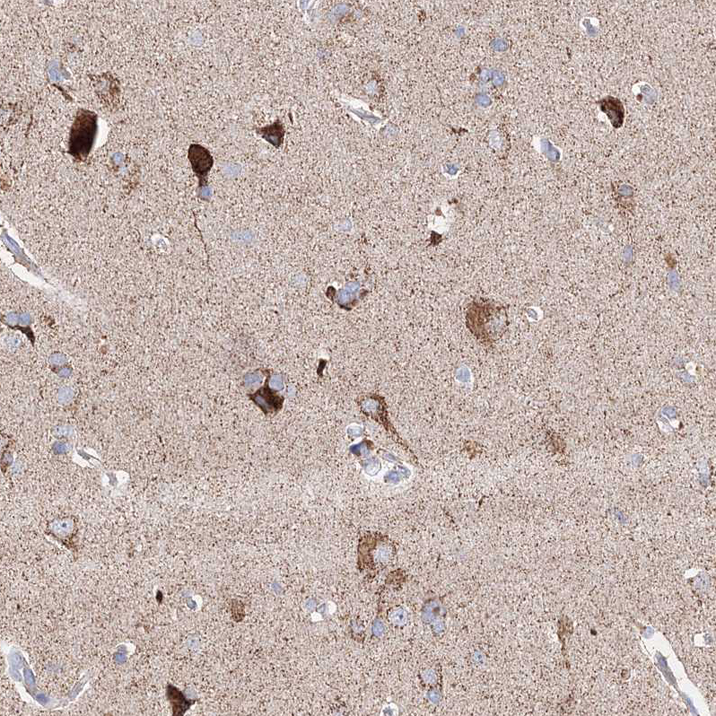 Immunohistochemistry (Formalin/PFA-fixed paraffin-embedded sections) - Anti-Glutaminase antibody (AB260047), expandable thumbnail